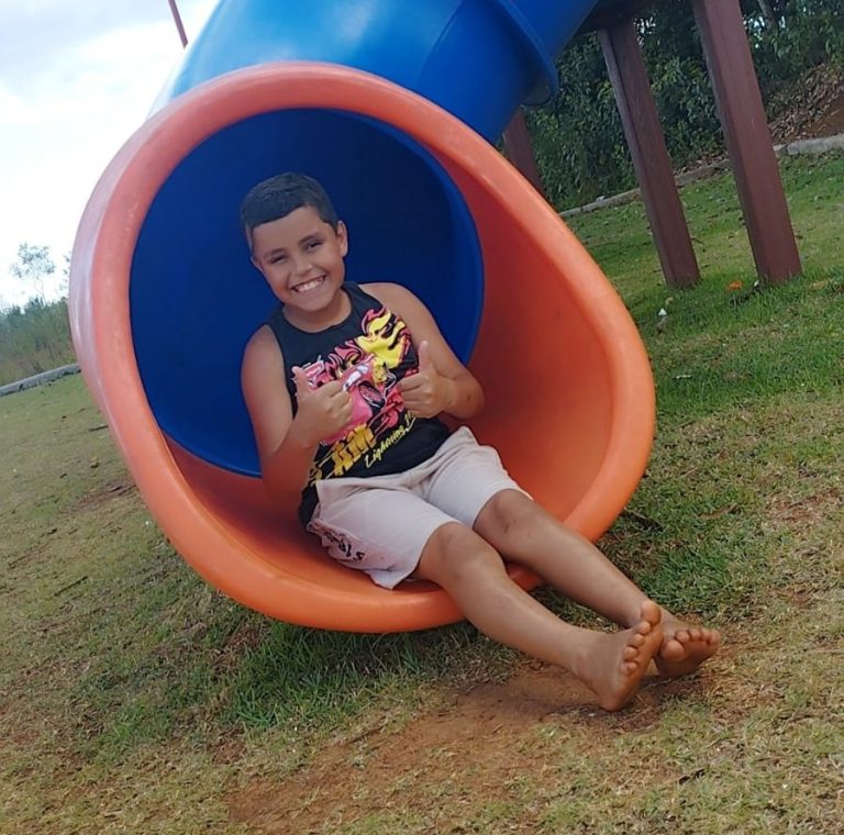 Um novo começo para Julian! Menino que sofreu queimaduras precisa de ajuda para prótese capilar