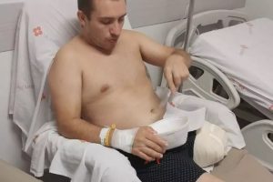Bactéria carnívora destrói perna de pintor de Ipira e família pede ajuda