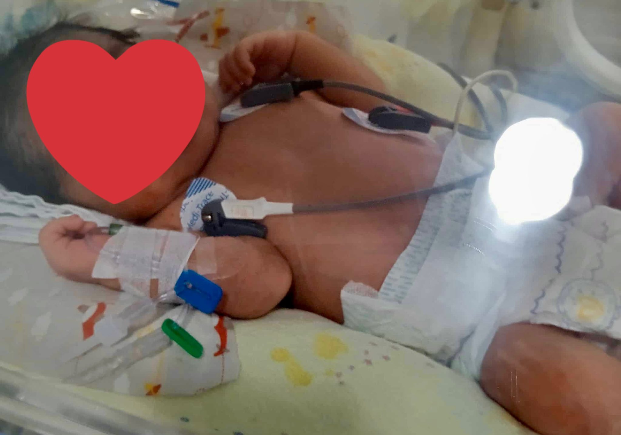 Família de Catanduvas pede ajuda para tratamento de bebê internada com condição rara