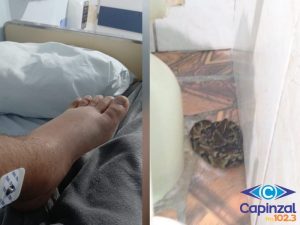 Adolescente é picado por jararaca dentro de casa em Capinzal