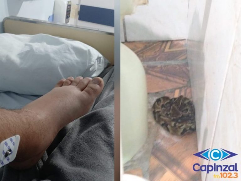 Adolescente é picado por jararaca dentro de casa em Capinzal