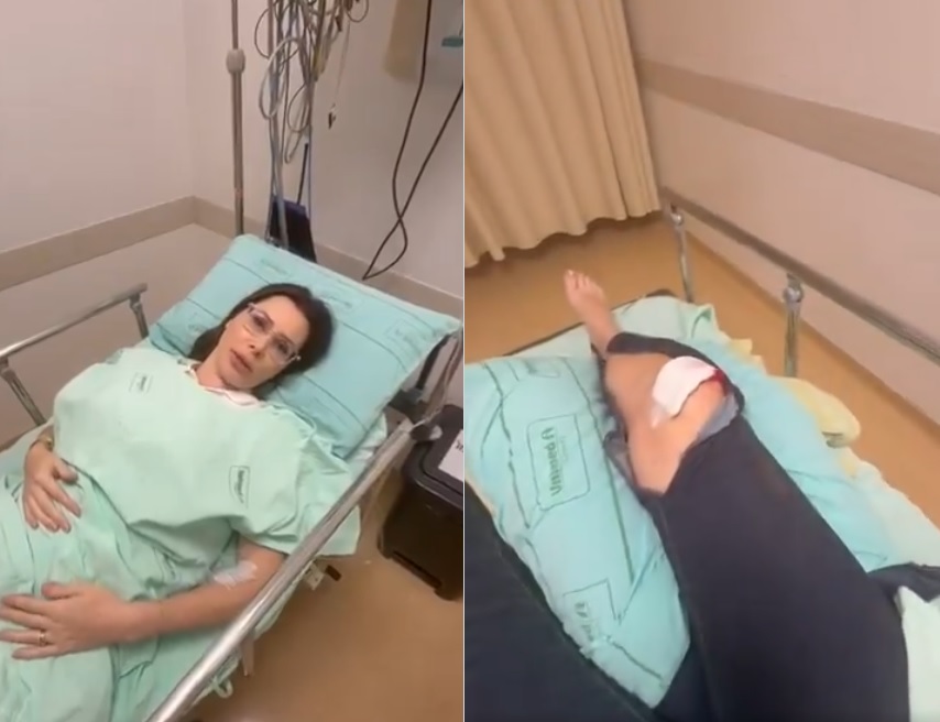 Deputada Carol de Toni sofre ataque de cachorro e fratura o joelho no Oeste