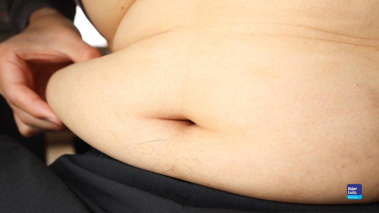 Obesidade atinge 38% de crianças e jovens no país