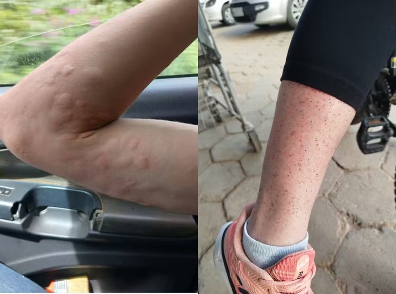 Infestação de mosquitos muda a rotina e obriga moradores a usarem casacos durante o calor em SC