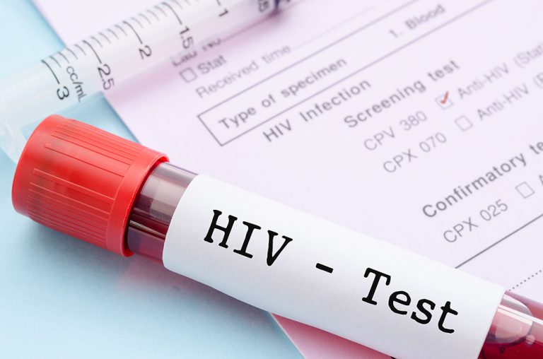 Fiocruz lança estudo inédito contra o HIV entre jovens