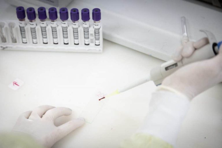 Brasil investiga dois casos suspeitos de ebola
