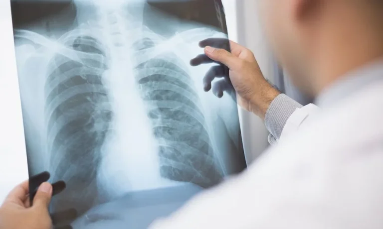 Anvisa aprova novos medicamentos para tratamento de câncer de pulmão avançado e de mama
