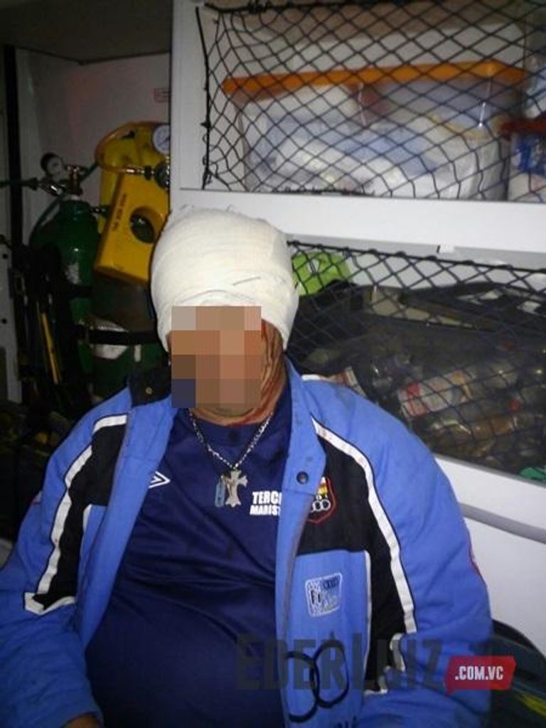 Briga de facão acaba com dois homens feridos