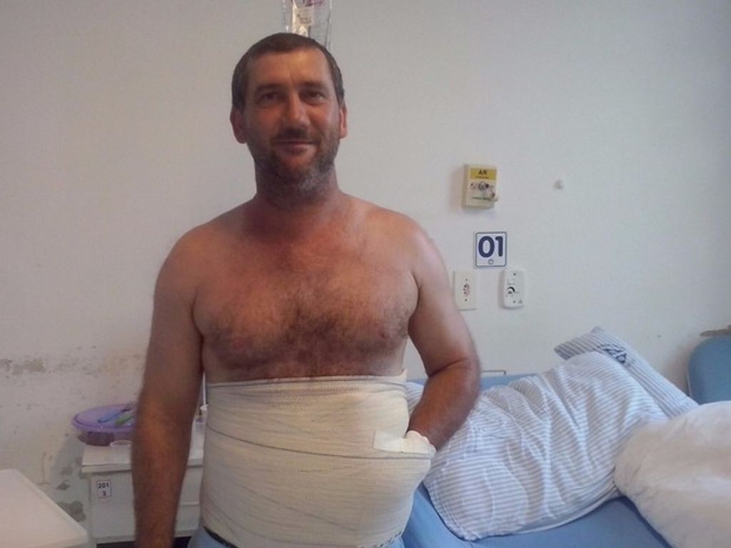 Para evitar amputação, homem ficará com mão dentro do abdômen em SC