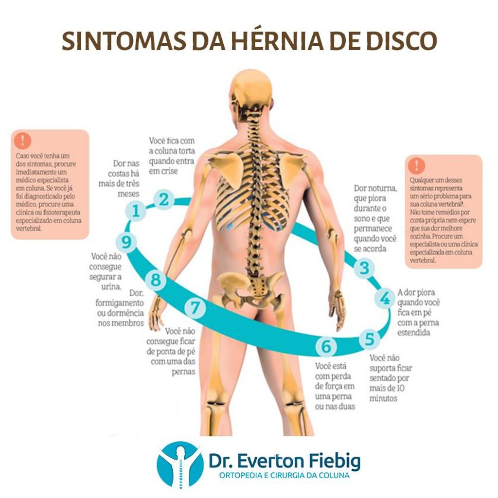 Sintomas da Hérnia de Disco