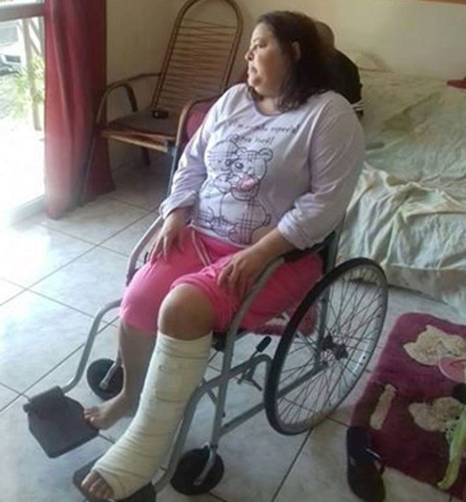 Família espera respostas para morte de mulher após cirurgia na perna