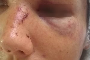 “Eu me senti um lixo”, diz mulher agredida por PMs em Mafra