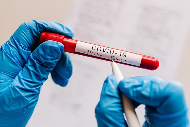 Brasil passa a exigir teste negativo de covid-19 para entrada no país