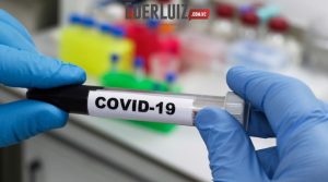 Casos ativos de Covid-19 chegam a 230 em Joaçaba